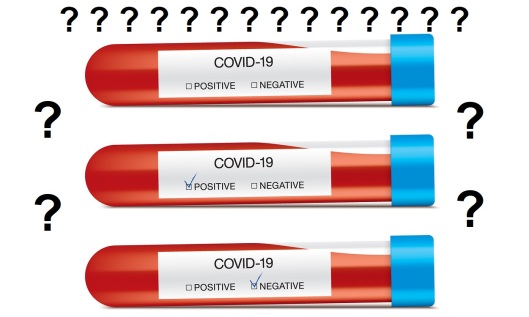 Covid-19 Blood Analysis, With Different Answers. Set Of Glass Ca